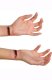 Slashed Wrist